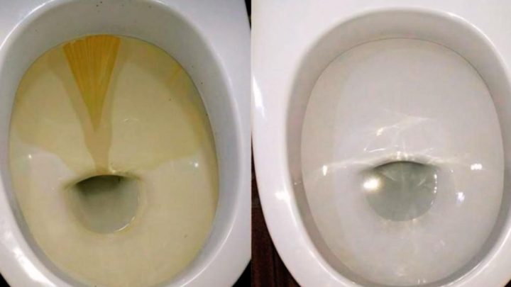 Простой стиральный порошок и идеальная белизна унитаза обеспечена